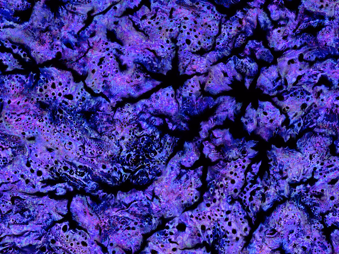 Kannabinõid – MASS (2023)